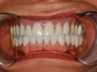 Konig Center for Cosmetic & Comprehensive Dentistry smile photos
